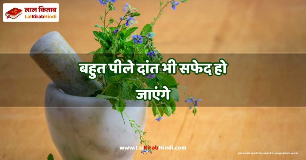 bahut peele daant bhee saphed ho jaenge