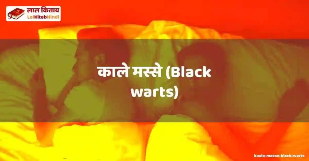 kaale masse (black warts)