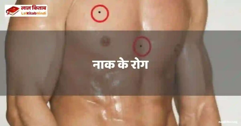 naak ke rog