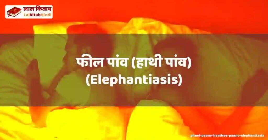 pheel paanv (haathee paanv) (elephantiasis)