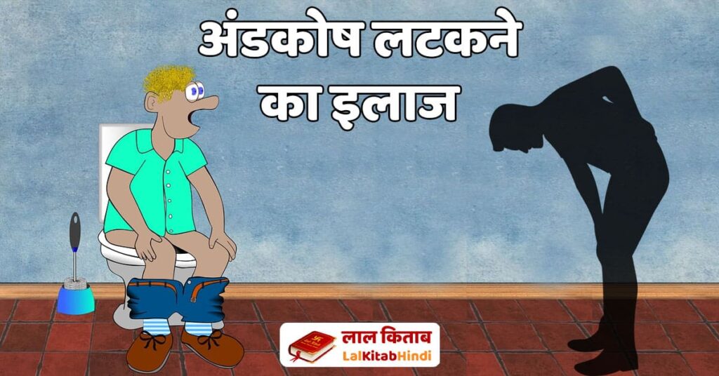 अंडकोष लटकने का इलाज